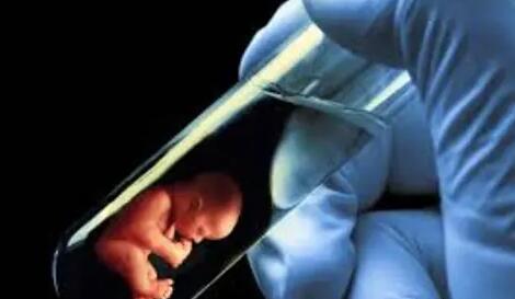 美国供精试管可否双胞胎美国试管婴儿双胞胎靠谱吗