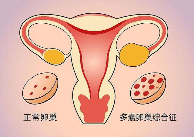 泰国试管备孕阶段做好检查就可以了并非如此